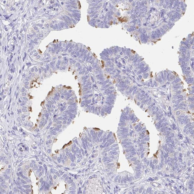 AKAP14 Antibody in Immunohistochemistry (Paraffin) (IHC (P))