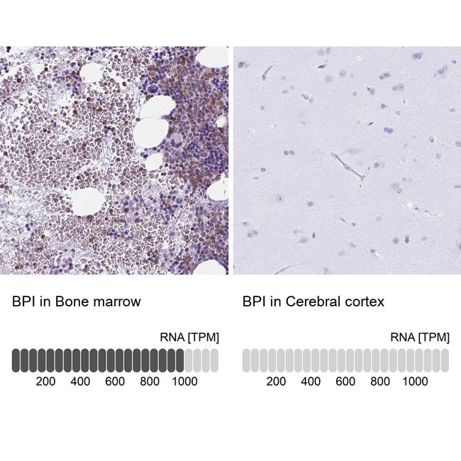 BPI Antibody in Immunohistochemistry (IHC)