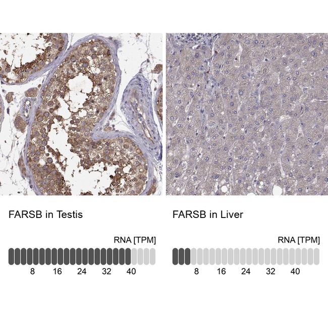 FARSB Antibody in Immunohistochemistry (IHC)