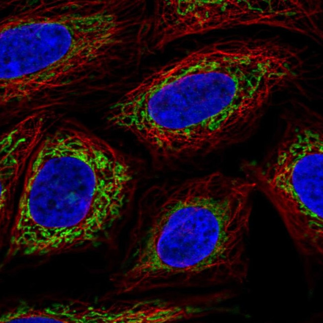 OXCT1 Antibody in Immunocytochemistry (ICC/IF)