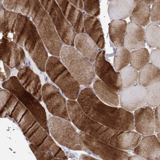 MYPN Antibody in Immunohistochemistry (Paraffin) (IHC (P))