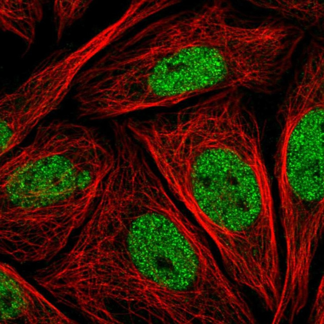 LMO4 Antibody in Immunocytochemistry (ICC/IF)