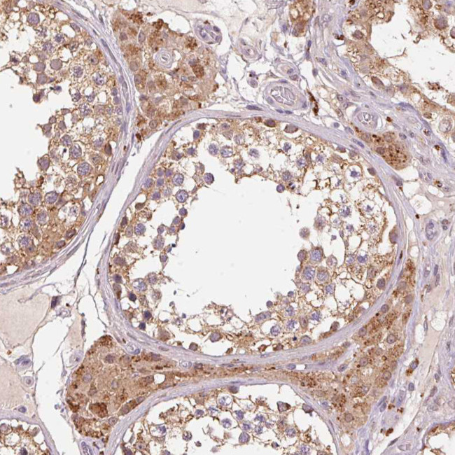 ADH5 Antibody in Immunohistochemistry (Paraffin) (IHC (P))