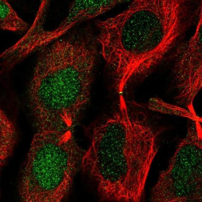 CHMP1B Antibody in Immunocytochemistry (ICC/IF)