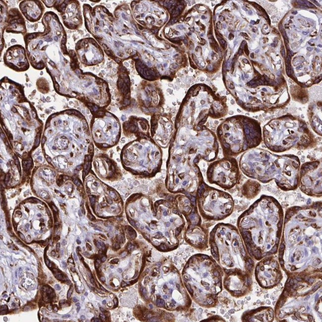 RCN1 Antibody in Immunohistochemistry (Paraffin) (IHC (P))