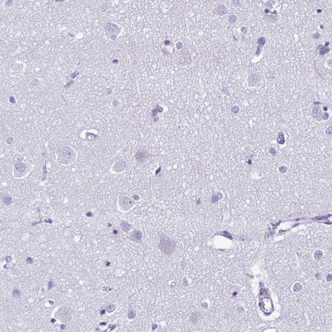 OVGP1 Antibody in Immunohistochemistry (Paraffin) (IHC (P))