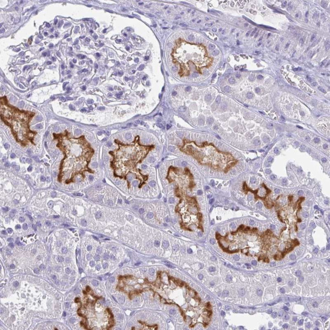 SLC36A2 Antibody in Immunohistochemistry (Paraffin) (IHC (P))