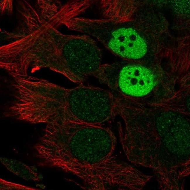 MAGEC2 Antibody in Immunocytochemistry (ICC/IF)