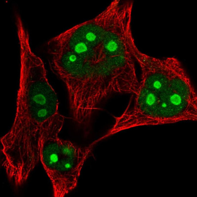 RSL24D1 Antibody in Immunocytochemistry (ICC/IF)