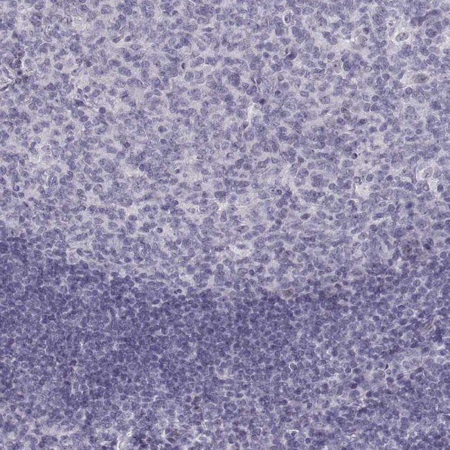 NANOS3 Antibody in Immunohistochemistry (Paraffin) (IHC (P))