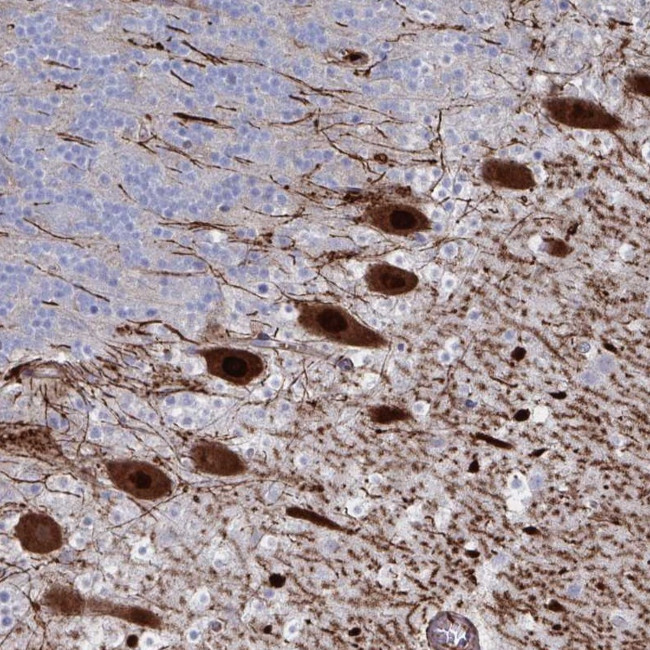 OR2T1 Antibody in Immunohistochemistry (Paraffin) (IHC (P))