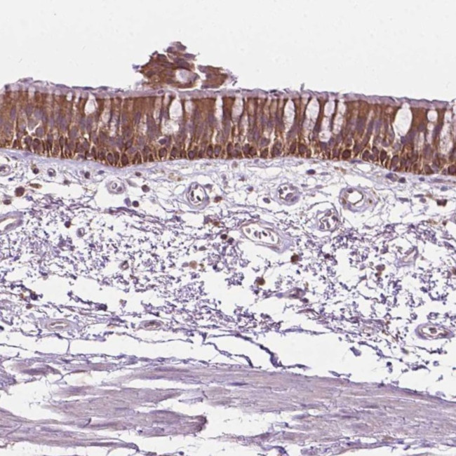 MZT1 Antibody in Immunohistochemistry (Paraffin) (IHC (P))