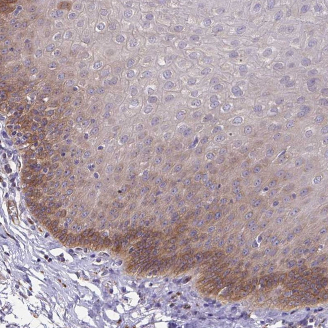 eIF3d Antibody in Immunohistochemistry (Paraffin) (IHC (P))