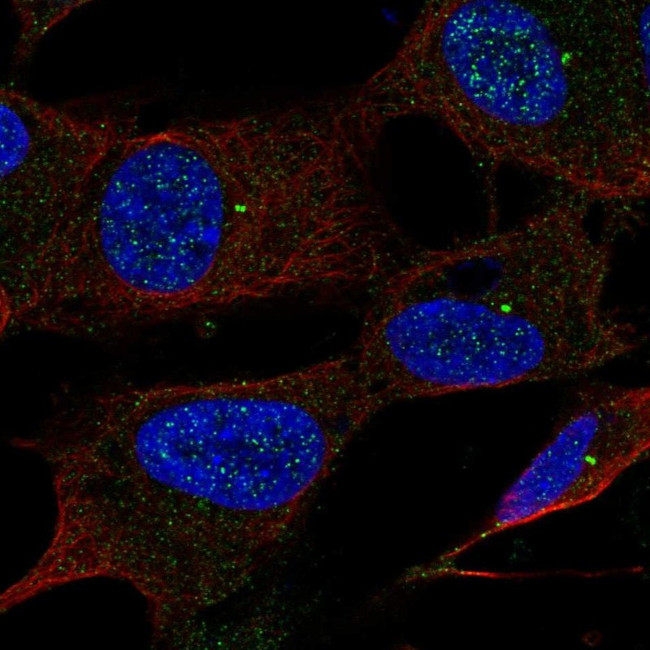 UBE2Q1 Antibody in Immunocytochemistry (ICC/IF)