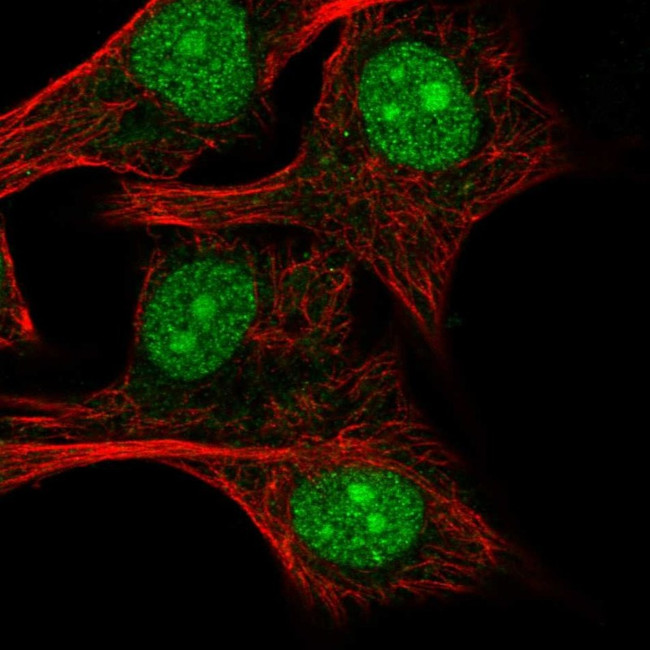 RSL24D1 Antibody in Immunocytochemistry (ICC/IF)