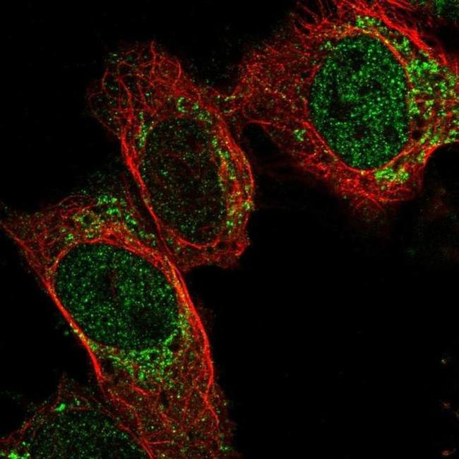 PDF Antibody in Immunocytochemistry (ICC/IF)