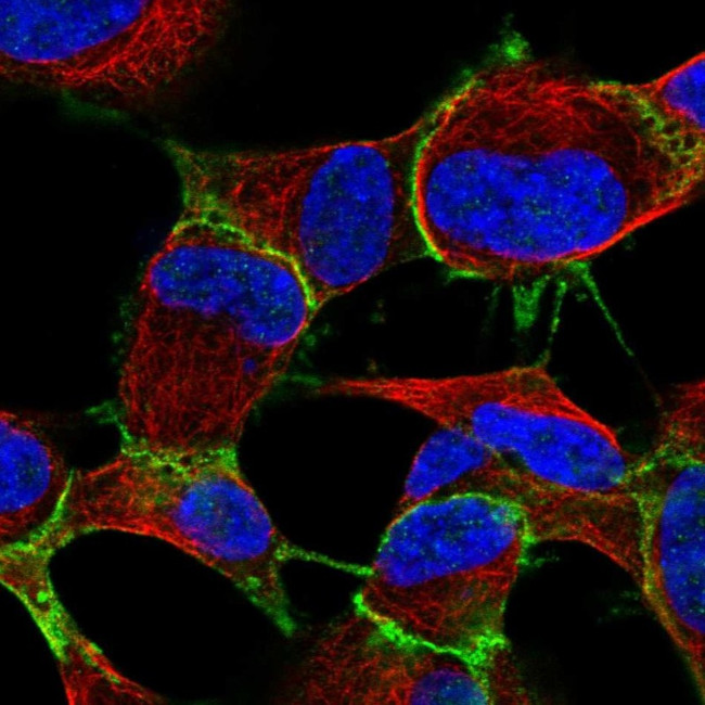 ARVCF Antibody in Immunocytochemistry (ICC/IF)