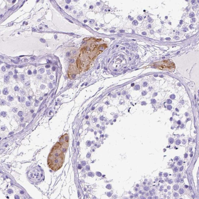 CTRP3 Antibody in Immunohistochemistry (Paraffin) (IHC (P))