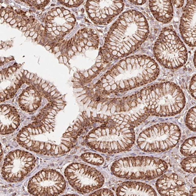 URM1 Antibody in Immunohistochemistry (Paraffin) (IHC (P))