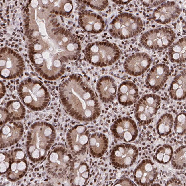 AMER1 Antibody in Immunohistochemistry (Paraffin) (IHC (P))