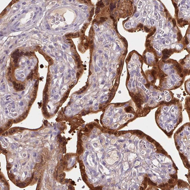 HSD17B1 Antibody in Immunohistochemistry (Paraffin) (IHC (P))