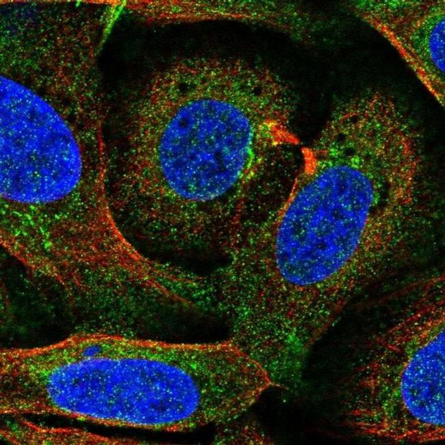 Ferroportin Antibody in Immunocytochemistry (ICC/IF)