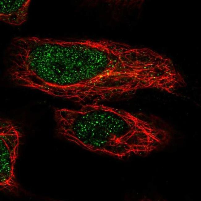 ZNF548 Antibody in Immunocytochemistry (ICC/IF)