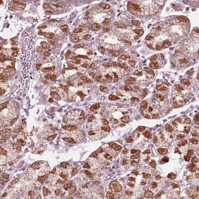 CLN6 Antibody in Immunohistochemistry (Paraffin) (IHC (P))