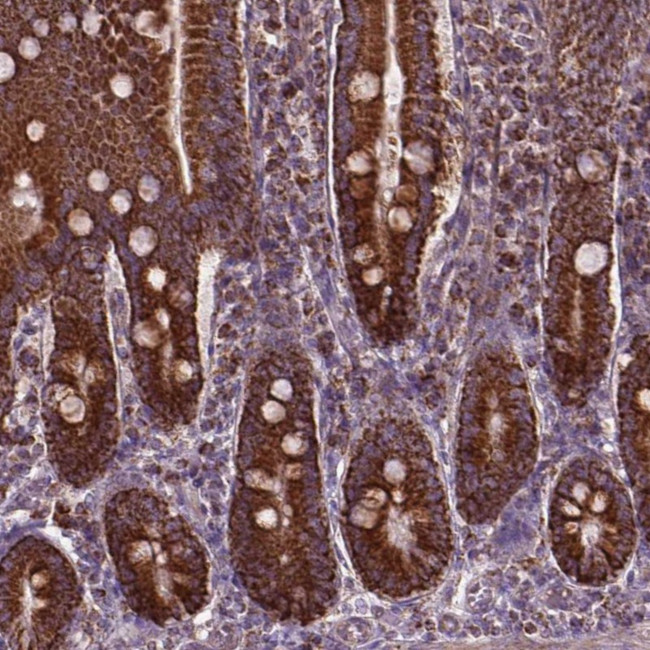 PIBF1 Antibody in Immunohistochemistry (Paraffin) (IHC (P))