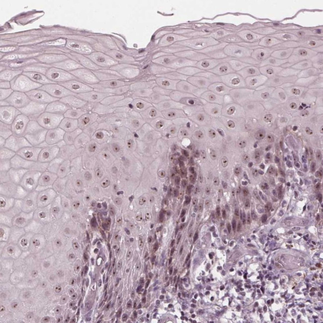 BTBD12 Antibody in Immunohistochemistry (Paraffin) (IHC (P))