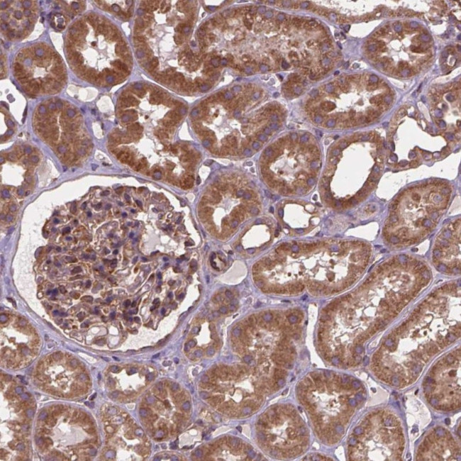 MZT1 Antibody in Immunohistochemistry (Paraffin) (IHC (P))