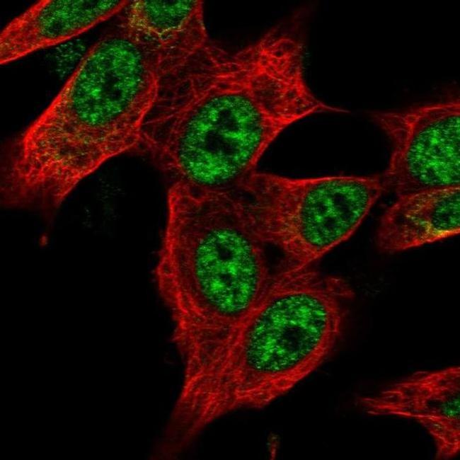 ZNF572 Antibody in Immunocytochemistry (ICC/IF)