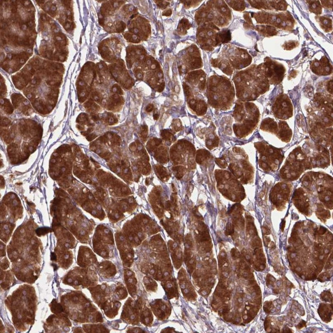 GAS1 Antibody in Immunohistochemistry (Paraffin) (IHC (P))