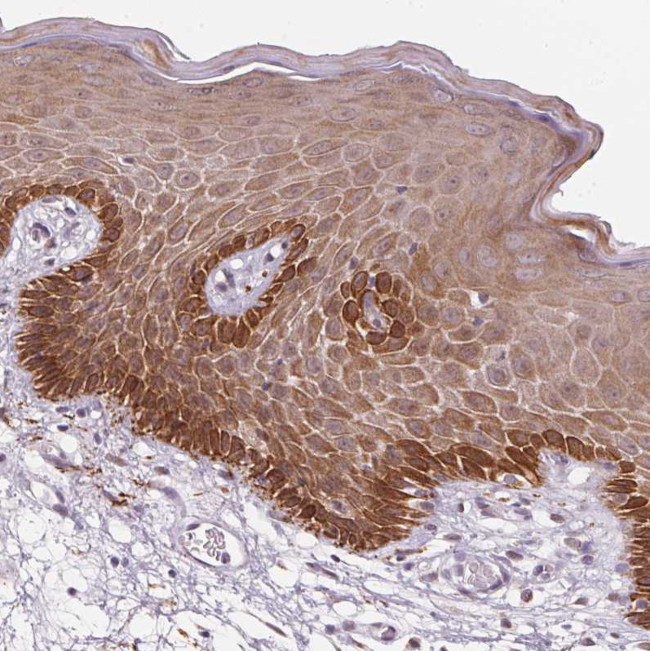 RAB22A Antibody in Immunohistochemistry (Paraffin) (IHC (P))