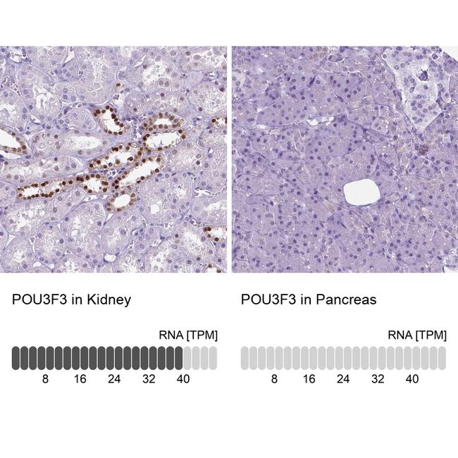 POU3F3 Antibody in Immunohistochemistry (IHC)