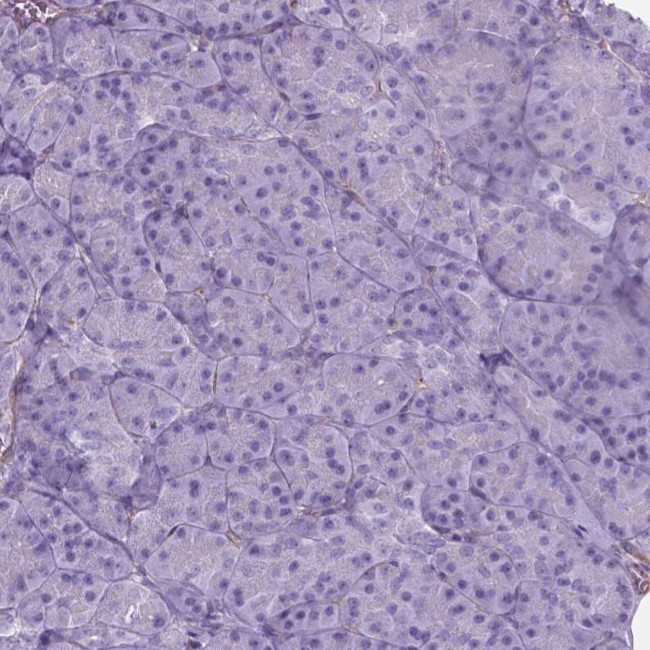 AMOT Antibody in Immunohistochemistry (Paraffin) (IHC (P))