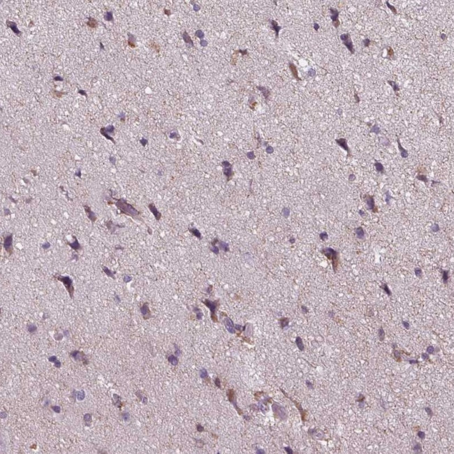 MLC1 Antibody in Immunohistochemistry (Paraffin) (IHC (P))