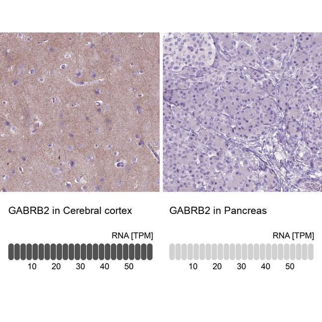 GABRB2 Antibody in Immunohistochemistry (IHC)