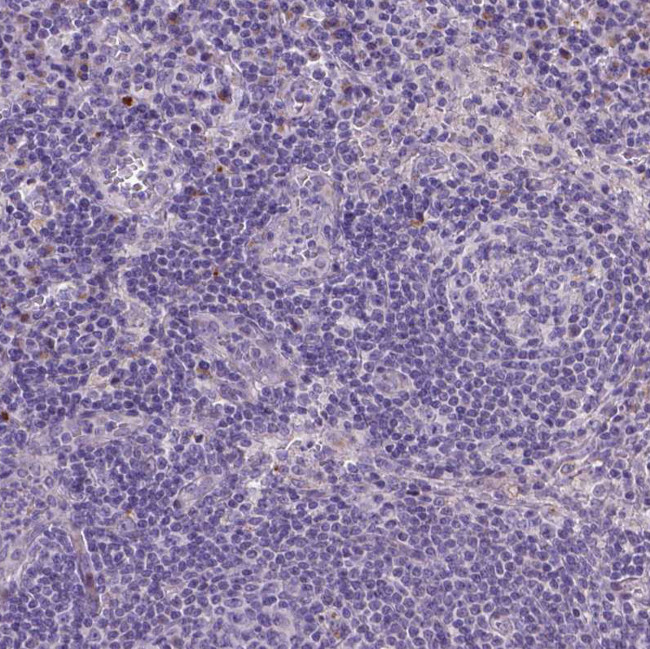 MYH14 Antibody in Immunohistochemistry (Paraffin) (IHC (P))