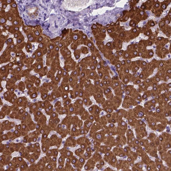 MACF1 Antibody in Immunohistochemistry (Paraffin) (IHC (P))