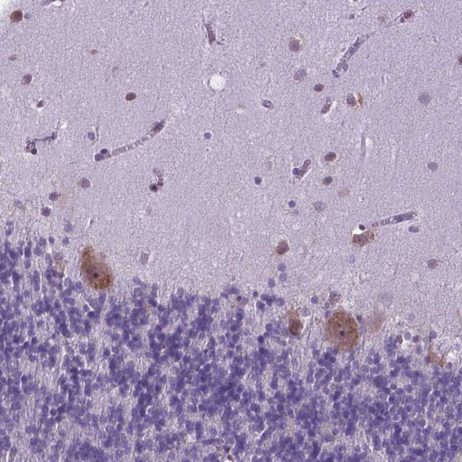 RPL6 Antibody in Immunohistochemistry (Paraffin) (IHC (P))