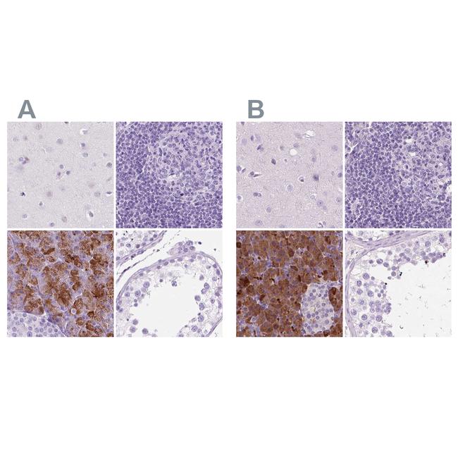 CUZD1 Antibody in Immunohistochemistry (IHC)