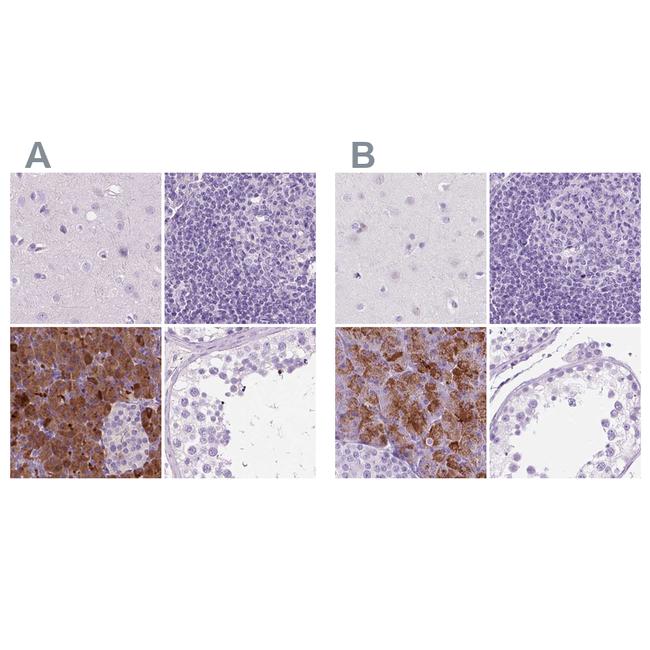 CUZD1 Antibody in Immunohistochemistry (IHC)