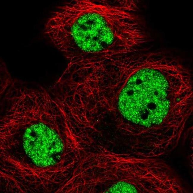 MED6 Antibody in Immunocytochemistry (ICC/IF)