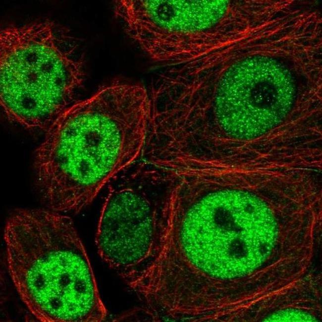 NCAPH2 Antibody in Immunocytochemistry (ICC/IF)