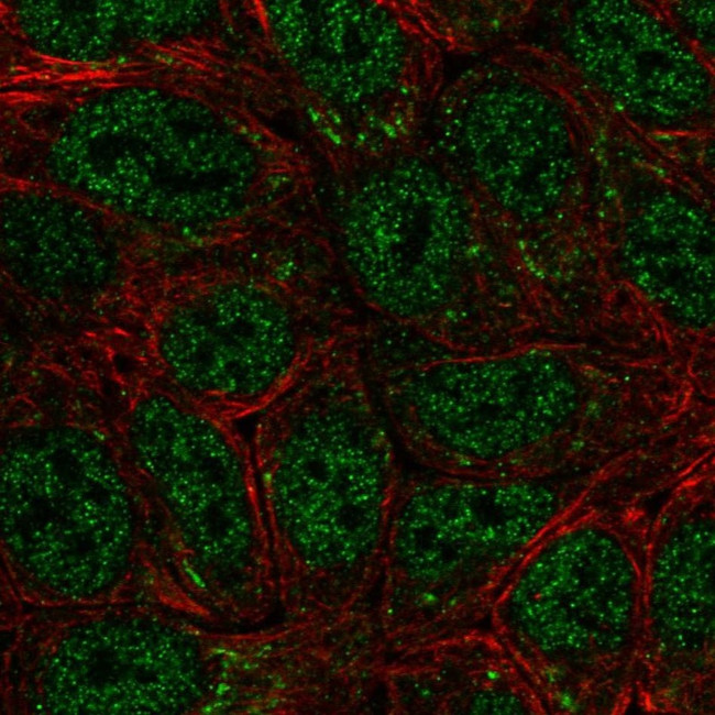 SEMA4A Antibody in Immunocytochemistry (ICC/IF)