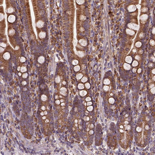 JIP3 Antibody in Immunohistochemistry (Paraffin) (IHC (P))