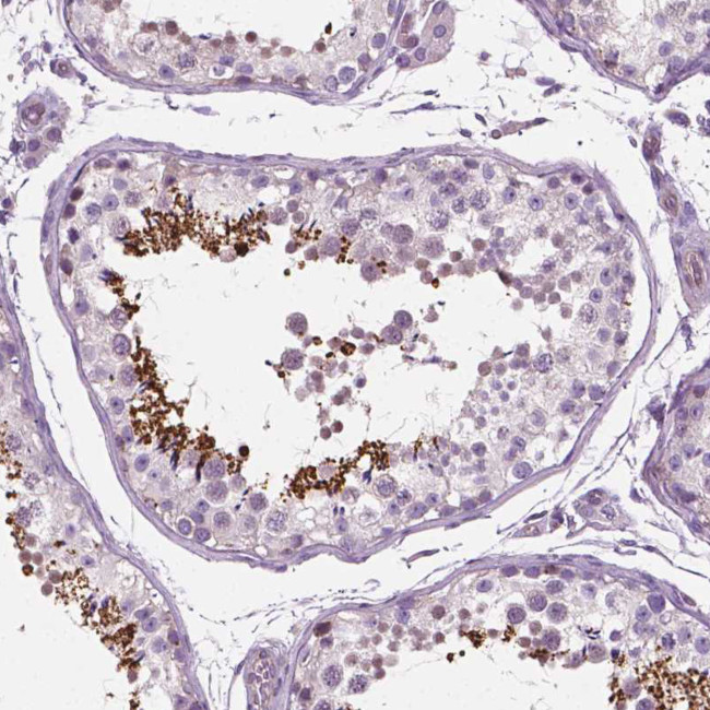 PTX3 Antibody in Immunohistochemistry (Paraffin) (IHC (P))