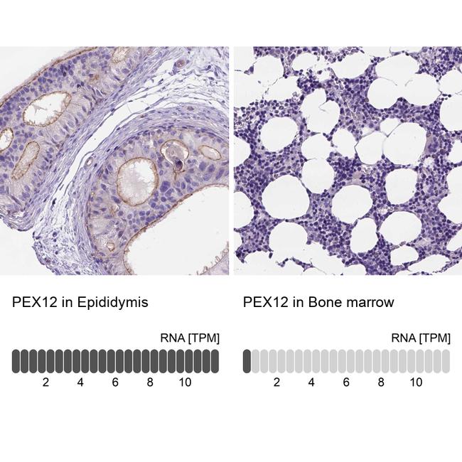 PEX12 Antibody in Immunohistochemistry (IHC)