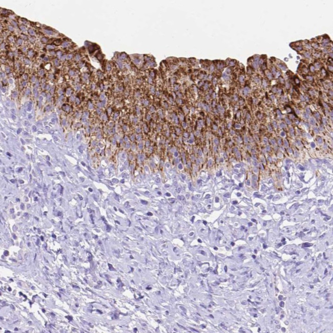 DHRS2 Antibody in Immunohistochemistry (Paraffin) (IHC (P))